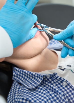 A person in a dental clinic receives treatment from another person wearing blue gloves, using dental instruments, with a focus on the mouth area.