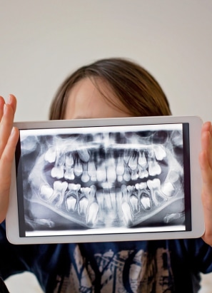 Young person holding up x-ray of teeth.